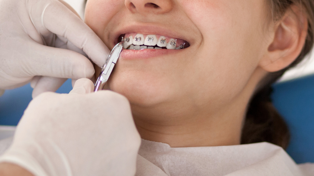 My Daughter Got Braces. I Nearly Ended Up in the Hospital.